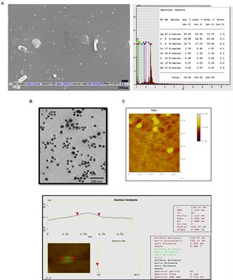 Antibacterial Potential of Jatropha curcas Synthesized Silver Nanoparticles against Food Borne Pathogens